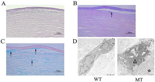 Pathological changes of MCD tissues observed by histologic and ultrastructural analysis.