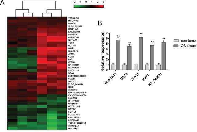 LncRNA microarray revealed the expression profiles in osteosarcoma tissue.