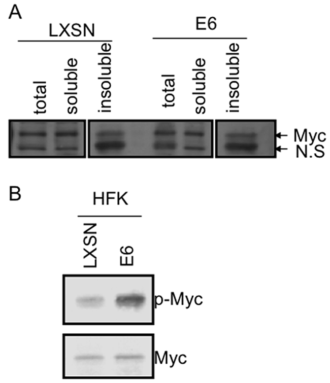 E6 increases Myc phosphorylation without induction of Myc expression.