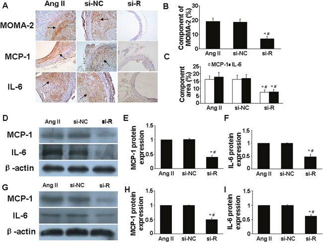 Effect of RELM&#x03B2; gene deletion on the infiltration of proinflammatory cells and expression levels of proinflammatory cytokines in vivo and in vitro.