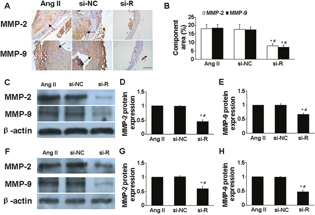 Effect of RELM&#x03B2; gene deletion on the expression of MMP-2 and MMP-9 in vivo and in vitro.