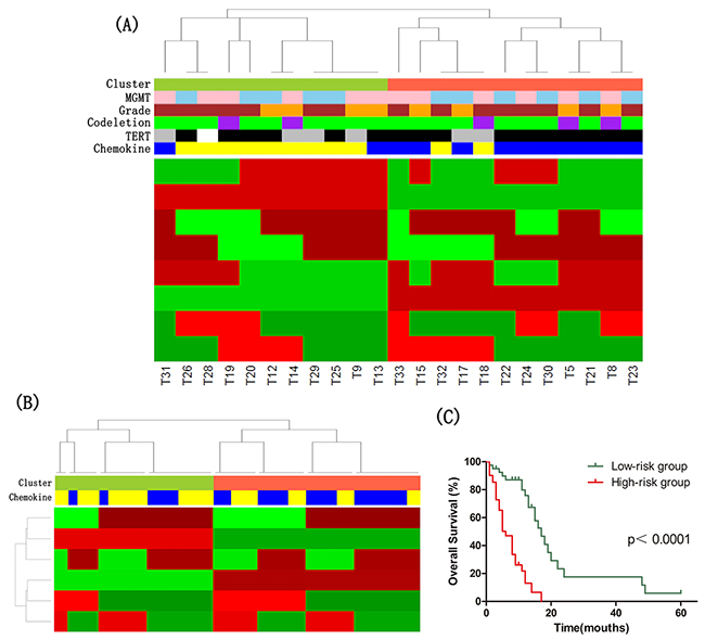 The molecular classification of IDH wild-type astrocytomas.