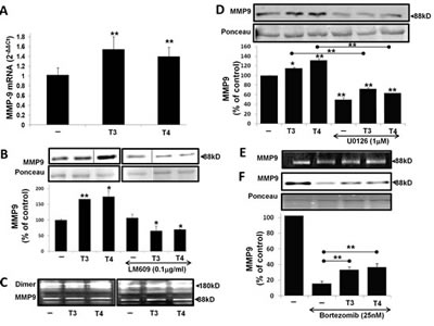 T3/T4 increase MMP-9 mRNA expression, protein level and activation via the MAPK pathway and oppose bortezomib.