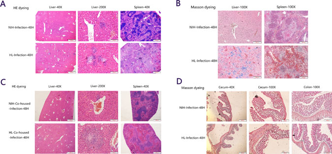 Histopathological lesions were more severe in HL mice than in NIH mice.