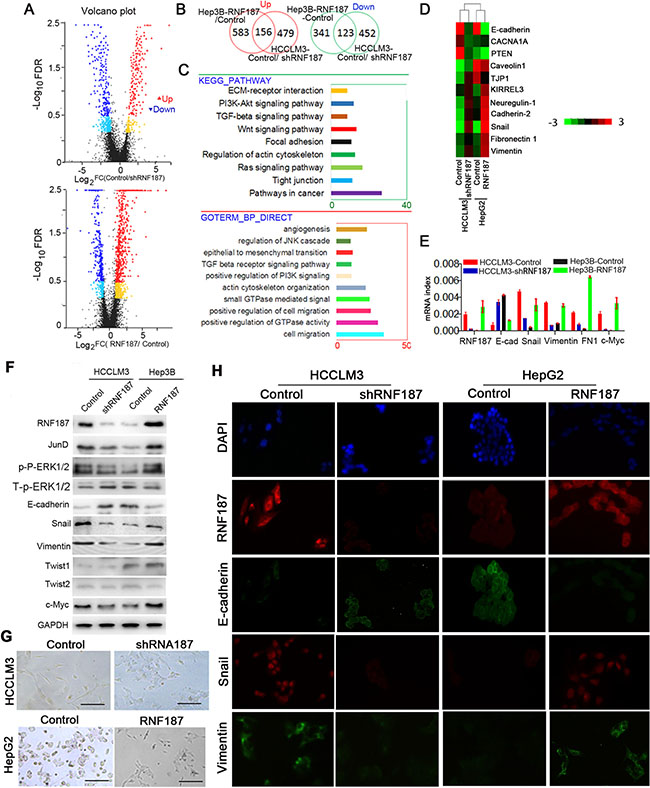 RNF187 overexpression induces an EMT in HCC cells.