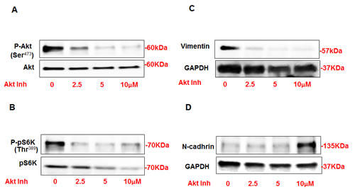 Inhibition of Akt resulted in significant decrease in vimentin and increase in N-cadherin expression in AML cells.