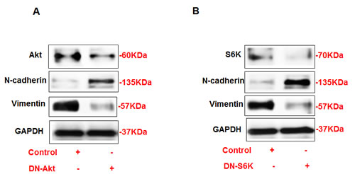 Opposite regulation of N-cadherin and vimentin by DN-Akt and DN-S6K in AML cells.