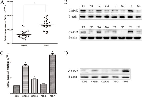 CAPN2 expression in RCC cell lines and tissues.