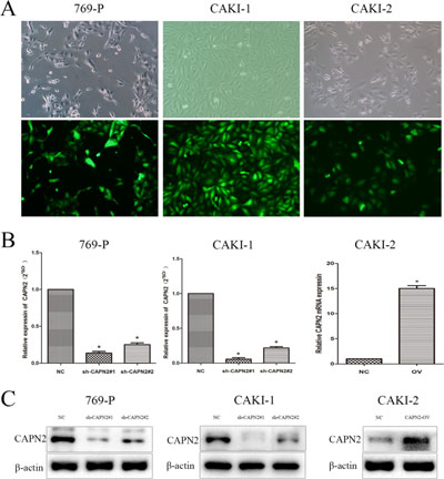 Transfection efficiency of lentivirus in 769-P, CAKI-1 and CAKI-2 cells.