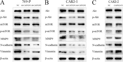 CAPN2 activates AKT/mTOR signaling, and enhances EMT process and MMP9 expression level.