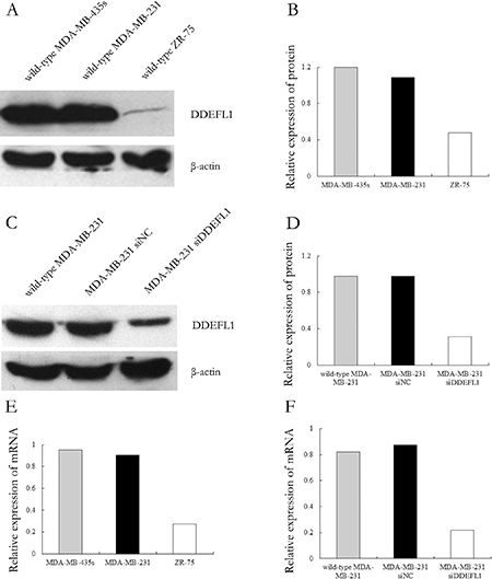 Expression patterns of DDEFL1 in breast cancer cell lines.