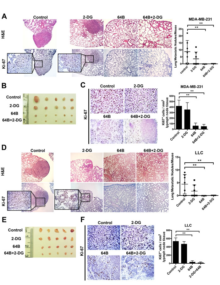 Combined treatment with 64B and 2-DG suppresses tumor metastasis.
