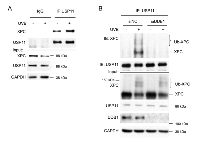 UVB induces USP11 interaction with XPC dependent on XPC ubiquitination levels.