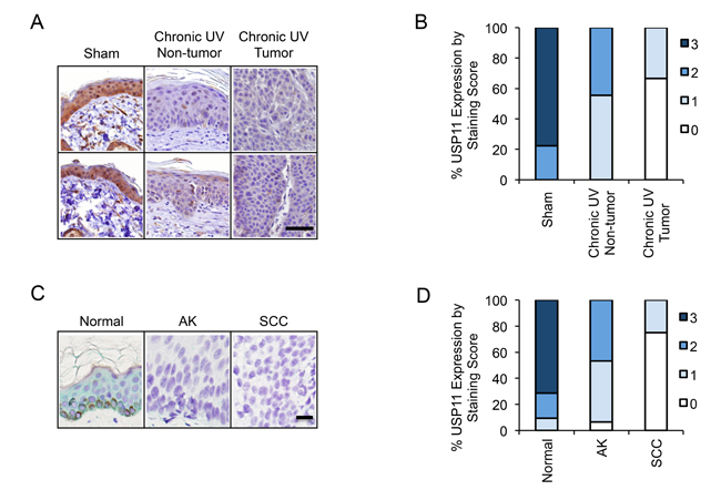 USP11 is down-regulated in mouse skin with chronic UV exposure, and in human and mouse skin tumors.