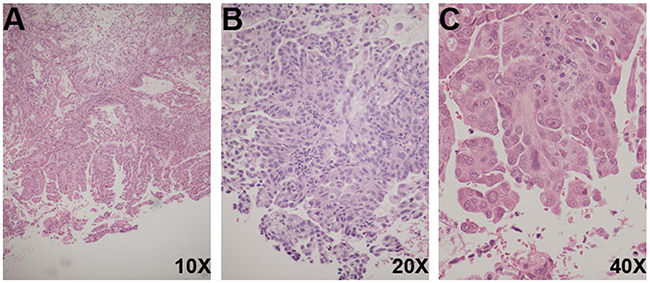 Histological features of DL biopsies.