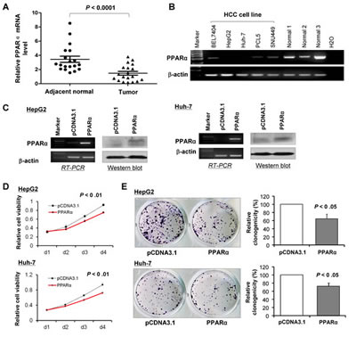 PPAR&#x3b1; is down-regulated in human HCCs and cell lines and its expression suppresses proliferation of HCC cells in vitro.
