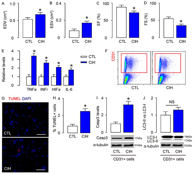 CIH causes increases in apoptosis but no changes in autophagy in mouse aortic endothelial cells.