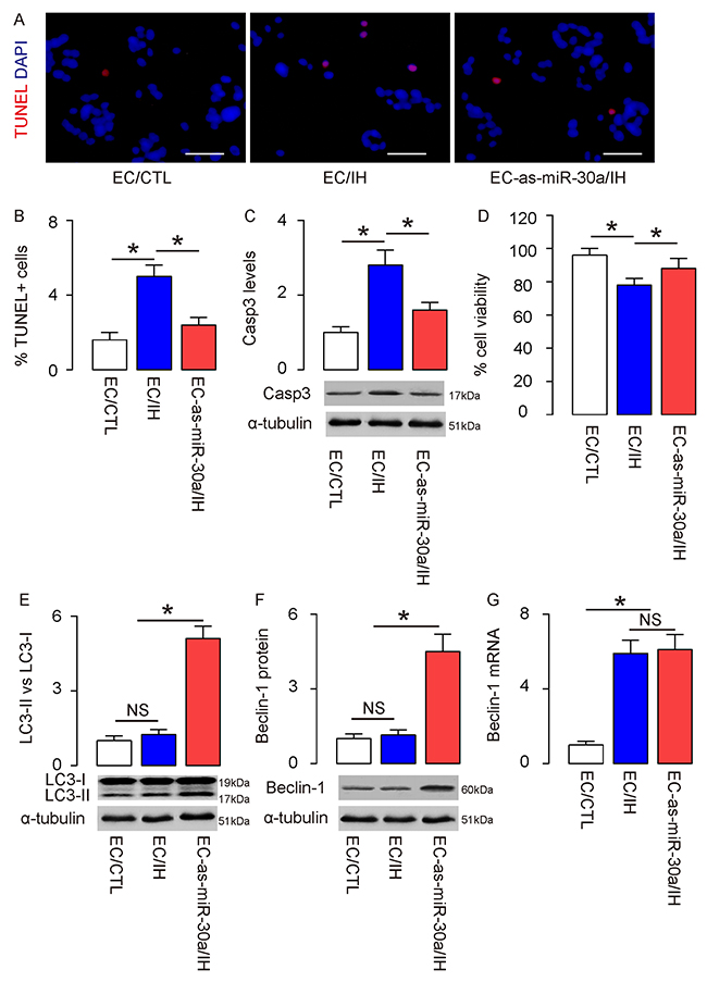 Suppression of miR-30a by as-miR-30a significantly increases CIH-associated endothelial cell autophagy in vitro.