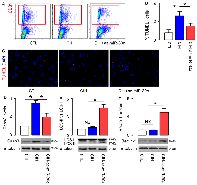 Suppression of miR-30a by as-miR-30a significantly increases CIH-associated endothelial cell autophagy and attenuates cardiac dysfunction in vivo.