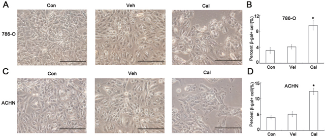 Calcitriol induces cell senescence of kidney cancer cells.