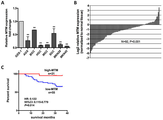 MTM expression is down regulated in human gastric cancer (GC) and related to patient survival.