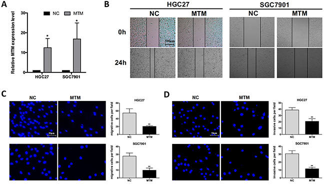 Overexpression of MTM inhibited the migration of gastric cancer (GC) cells.
