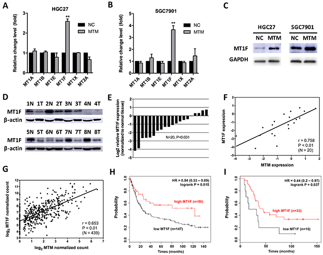 MTM and MT1F are coordinately expressed in gastric cancer (GC).