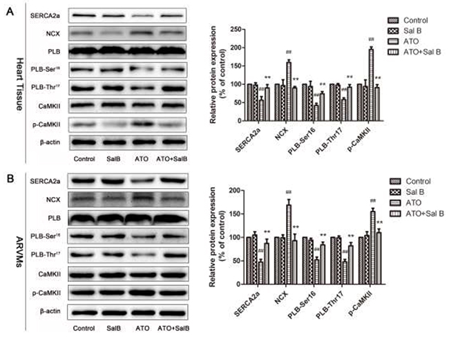 Effect of Sal B on Ca2+ handling protein levels after ATO treatment.