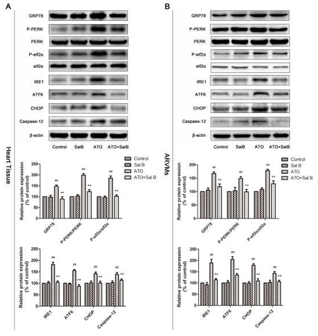 Effect of Sal B on ER stress-related protein levels after ATO treatment.