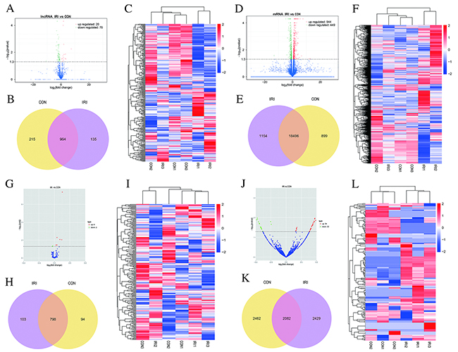 Changes in the expression profile of lncRNAs, mRNAs, miRNAs and circRNAs in the kidneys of mice subjected to IR.