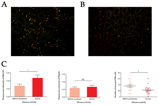 Immunofluorescence of mucosal NKG2D+ NKp46+ NK cells in UC patients of different disease activity.