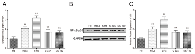 The expression of NF-&#x03BA;B p65 in different cervical cancer cell lines and human cervical epithelial cells H8.