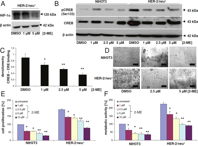 Modulation of CREB activity, proliferation and metabolic activity upon treatment with the HIF-1&#x03B1; inhibitor 2-methoxyestradiol.
