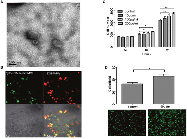 PMPs induce proliferation and migration of ovarian cancer cells.