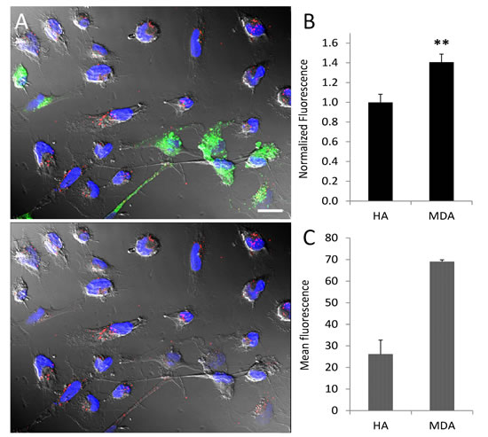 Tumor selective targeting of SapC-DOPS-CVM in co-cultured astrocytes and tumor cells.