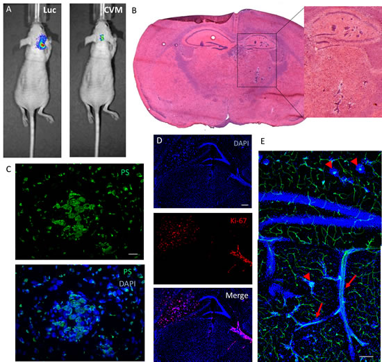 Brain metastasis mouse model: SapC-DOPS-targeting and anatomical and molecular features.