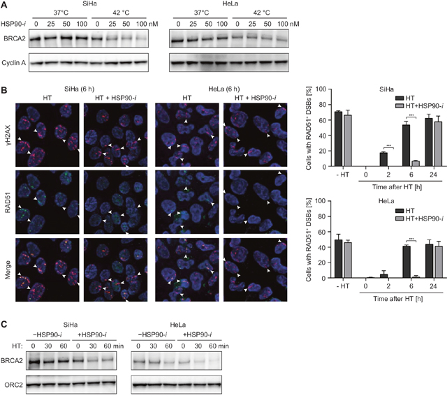 HSP90 inhibitor Ganetespib potentiates the effects of hyperthermia (HT) on HR.