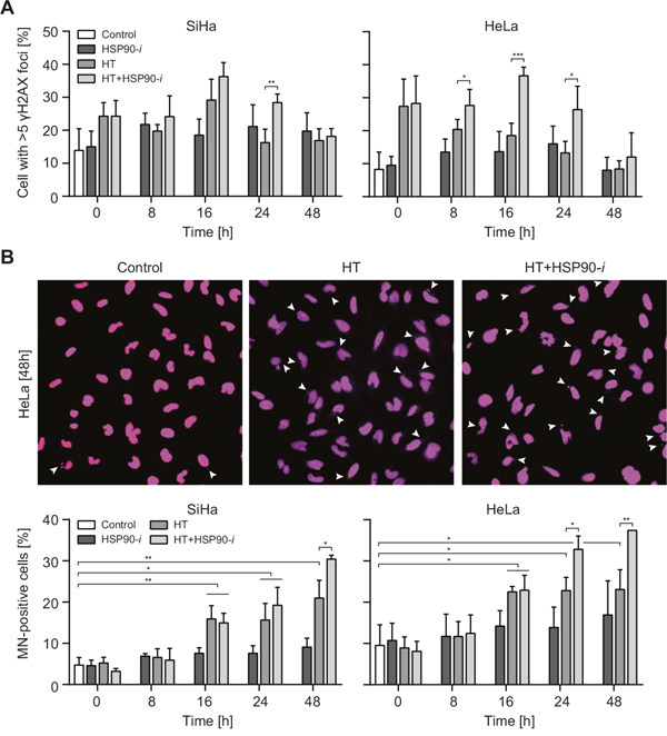 Inhibition of HSP90 enhances induction of DNA damage by hyperthermia (HT).