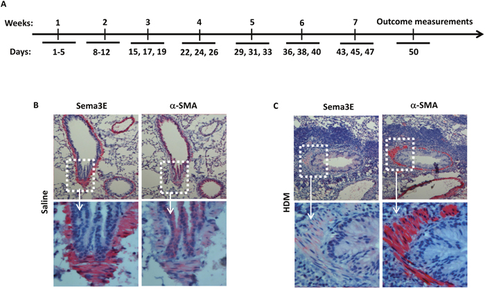 Sema3E expression is suppressed upon chronic HDM exposure.