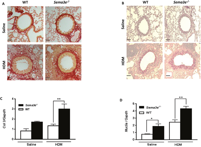 Collagen deposition and mucus overproduction is elevated in Sema3E deficient mice.