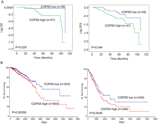 Jab1/COPS5 predicts survival in lung and breast cancer.