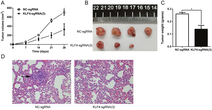 KLF4 inhibited tumor growth and lung metastasis in vivo.