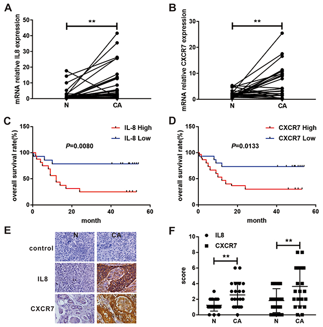 Expression and survival significance of IL8 and CXCR7 in patients with EC.