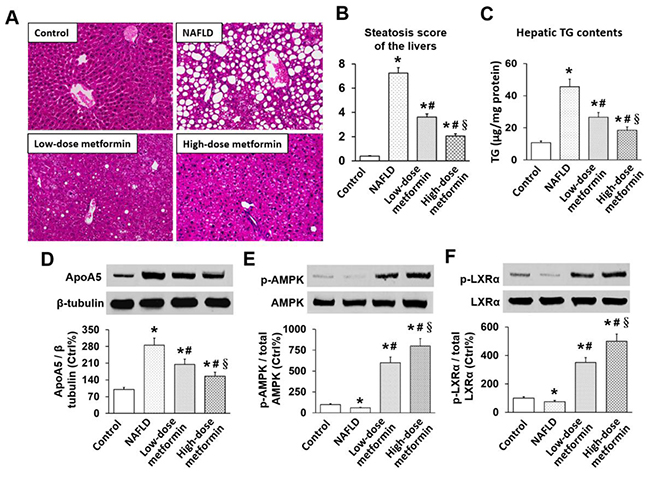 Effects of metformin on hepatic steatosis, TG, apoA5, and phosphorylation of AMPK and LXR&#x03B1; in mice.
