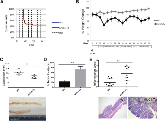 MUC1 promotes inflammation and tumorigenesis in AOM/DSS-treated mice.