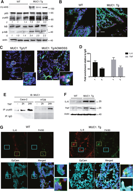 MUC1 promotes expression of NF-&kappa;B-dependent pro-inflammatory cytokines in IECs after AOM/DSS administration.