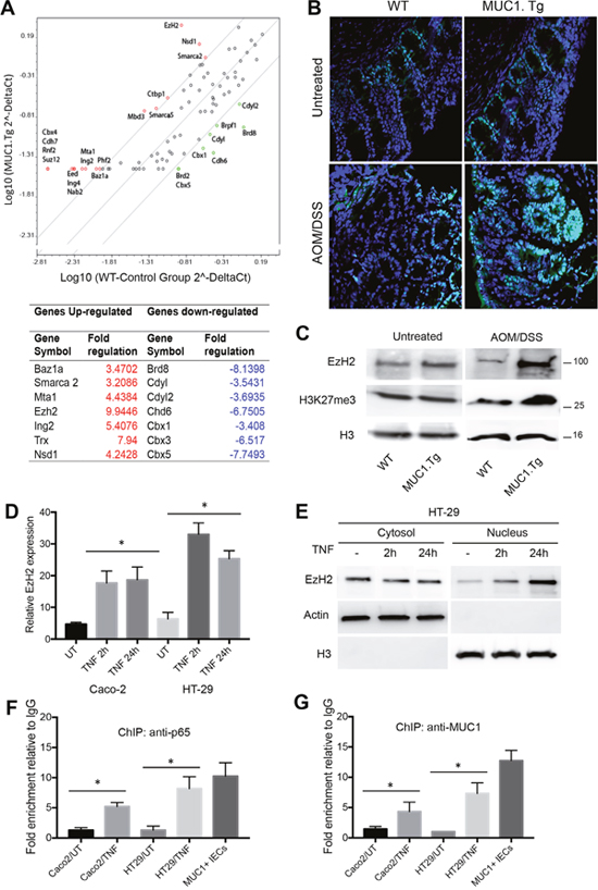 AOM/DSS-treatment up-regulated EzH2 expression via NF-&kappa;B pathway activation in IECs of MUC1.Tg.