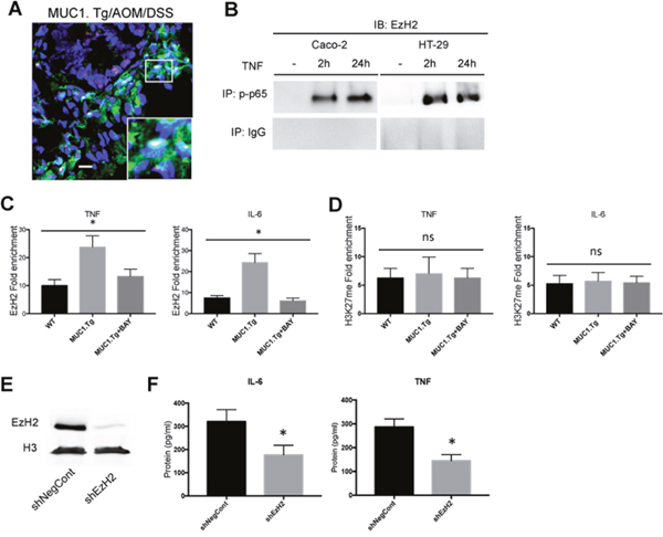 EzH2 regulates inflammatory cytokines expression in MUC1+ IECs from AOM/DSS-treated mice.