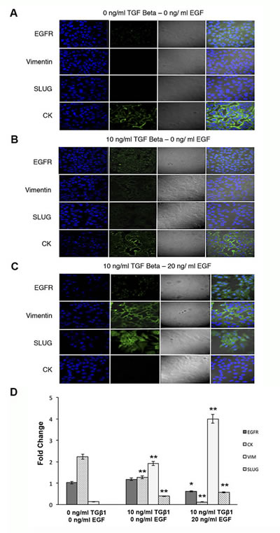 Expression of EGFR, VIM, Slug and CK in MCF-7 cells after TGF&#x3b2;1 and/or EGF induction.