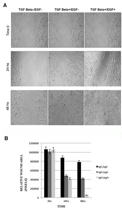 Wound healing assays in MCF-7 cells after induction with TGF&#x3b2;1 and/or EGF.